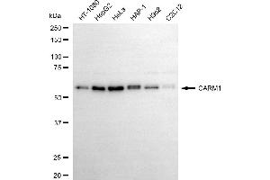 anti-Coactivator-Associated Arginine Methyltransferase 1 (CARM1) antibody