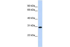 WB Suggested Anti-SMNDC1 Antibody Titration:  0. (SMNDC1 antibody  (Middle Region))