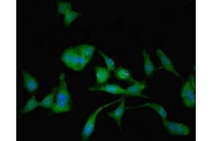 Immunofluorescent analysis of Hela cells using ABIN7143903 at dilution of 1:100 and Alexa Fluor 488-congugated AffiniPure Goat Anti-Rabbit IgG(H+L)