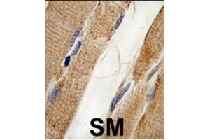 Formalin-fixed and paraffin-embedded human skeletal muscle tissue reacted with PI3KC3 Antibody , which was peroxidase-conjugated to the secondary antibody, followed by DAB staining. (PIK3C3 antibody  (AA 405-430))