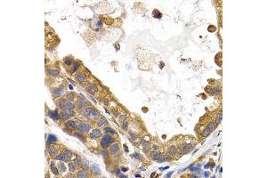 Immunohistochemistry (IHC) image for anti-Glycogen Synthase 1 (Muscle) (GYS1) (AA 488-737) antibody (ABIN3016178) (Glycogen Synthase 1 antibody  (AA 488-737))