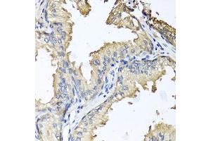Immunohistochemistry of paraffin-embedded human prostate using CXCR4 antibody (ABIN6292854) at dilution of 1:100 (40x lens).