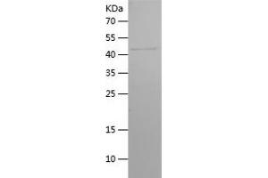 FSHR Protein (AA 35-240) (His-IF2DI Tag)