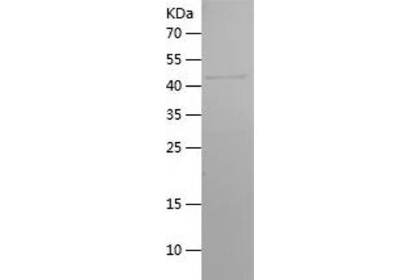 FSHR Protein (AA 35-240) (His-IF2DI Tag)