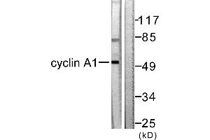 Western blot analysis of extracts from SKOV3 cells, using Cyclin A1 antibody (#C0166). (Cyclin A1 antibody)