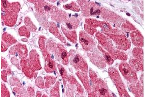 Human Heart (formalin-fixed, paraffin-embedded) stained with MAPK1 antibody ABIN305764 at 5 ug/ml followed by biotinylated anti-mouse IgG secondary antibody ABIN481714, alkaline phosphatase-streptavidin and chromogen. (ERK2 antibody)
