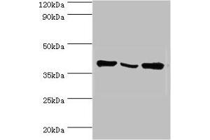 Western blot All lanes: EIF3H antibody at 6 μg/mL Lane 1: NIH/3T3 whole cell lysate Lane 2: Rat brain tissue Lane 3: U251 whole cell lysate Secondary Goat polyclonal to rabbit IgG at 1/10000 dilution Predicted band size: 40 kDa Observed band size: 40 kDa (EIF3H antibody  (AA 80-340))