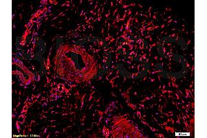 Formalin-fixed and paraffin embedded rabbit meniscus tissue labeled Anti-Collagen II Polyclonal Antibody, Unconjugated (ABIN672171) at 1:200, followed by conjugation to the secondary Goat Anti-Rabbit IgG, Cy3 conjugated used at 1:200 dilution for 40 minutes at 37°C. (COL2 antibody  (AA 1201-1300))