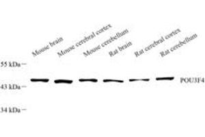 POU3F4 antibody