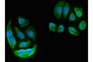 Immunofluorescent analysis of A549 cells using ABIN7151774 at dilution of 1:100 and Alexa Fluor 488-congugated AffiniPure Goat Anti-Rabbit IgG(H+L) (ELMO2 antibody  (AA 304-371))