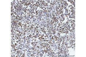 IHC analysis of GLUD1/2 using anti-GLUD1/2 antibody (ABIN7602000). (GLUD1 / GLUD2 (AA 54-553) antibody)