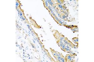 Immunohistochemistry of paraffin-embedded mouse lung using ApoE antibody (ABIN5975768) at dilution of 1/100 (40x lens). (APOE antibody)