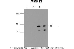 Sample Type: 1. (MMP13 antibody  (Middle Region))
