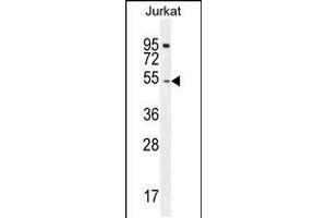 Western blot analysis in Jurkat cell line lysates (35ug/lane). (DARS antibody  (N-Term))