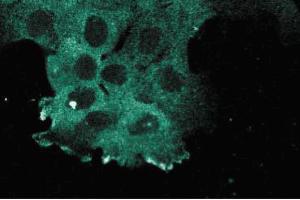Immunofluorescence staining of A431 cells. (KIF11 antibody  (AA 324-532))