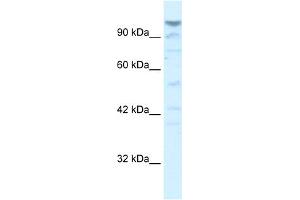 WB Suggested Anti-LAntibody Titration:  5. (LARP1B antibody  (Middle Region))