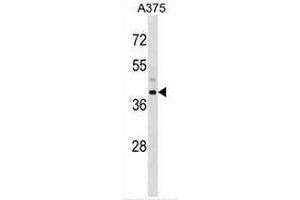 Western blot analysis in A375 cell line lysates (35ug/lane) using Snurportin-1 (SNUPN) Antibody . (Snurportin 1 antibody  (Middle Region))