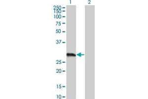 Western Blot analysis of VCX3A expression in transfected 293T cell line by VCX3A monoclonal antibody (M01), clone 6A3.