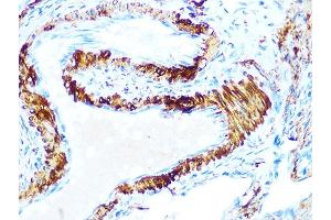 Immunohistochemistry (IHC) image for anti-Protein Kinase, AMP-Activated, beta 1 Non-Catalytic Subunit (PRKAB1) antibody (ABIN7269654)