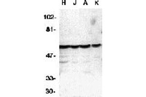 Western Blotting (WB) image for anti-Caspase 10, Apoptosis-Related Cysteine Peptidase (CASP10) (C-Term) antibody (ABIN1030316) (Caspase 10 antibody  (C-Term))