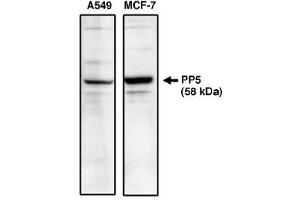 Image no. 1 for anti-Protein Phosphatase 5, Catalytic Subunit (PPP5C) antibody (ABIN265046) (PP5 antibody)