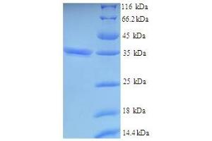 SDS-PAGE (SDS) image for V-Set and Transmembrane Domain Containing 2 Like (VSTM2L) (AA 25-204) protein (His-SUMO Tag) (ABIN5711608)