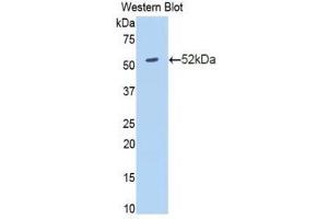Western Blotting (WB) image for anti-Amyloid P Component, Serum (APCS) (AA 23-223) antibody (ABIN1860495) (APCS antibody  (AA 23-223))