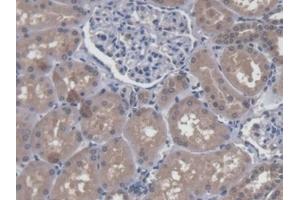 DAB staining on IHC-P; Samples: Human Kidney Tissue (LUC7-Like 3 antibody  (AA 1-247))