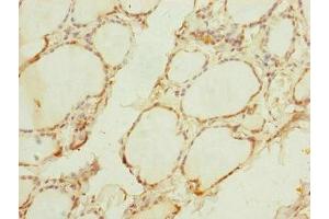 Immunohistochemistry of paraffin-embedded human thyroid tissue using ABIN7159887 at dilution of 1:100 (TIMM1B (AA 1-103) antibody)