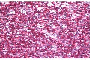 Immunohistochemistry staining of human tonsil (paraffin sections) using anti-CD45RB (clone MEM-143). (CD45RB antibody)
