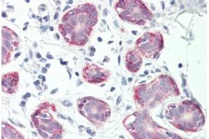 Human Breast: Formalin-Fixed, Paraffin-Embedded (FFPE) (RXFP2 antibody  (C-Term))