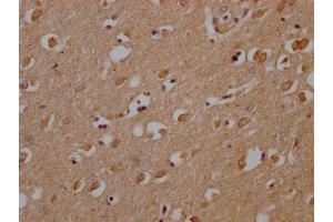IHC image of ABIN7139953 diluted at 1:200 and staining in paraffin-embedded human brain tissue performed on a Leica BondTM system.