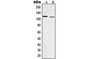 Western blot analysis of Focal Adhesion Kinase (pY861) expression in HUVEC (A), HeLa (B) whole cell lysates. (FAK antibody  (C-Term, pTyr861))
