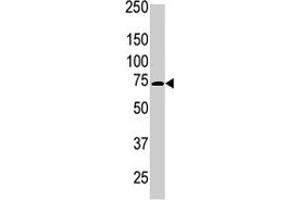 The PRKCB polyclonal antibody  is used in Western blot to detect PRKCB beta2 in Jurkat cell lysate . (PKC beta antibody  (C-Term))