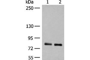 Western blot analysis of Rat brain tissue and Mouse brain tissue lysates using NGEF Polyclonal Antibody at dilution of 1:250 (NGEF antibody)