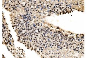 IHC analysis of CPSF6 using anti-CPSF6 antibody (ABIN7601898).