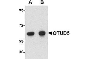 Western blot analysis of OTUD5 in human kidney lysate with OTUD5 antibody at (A) 1 and (B) 2 μg/ml.
