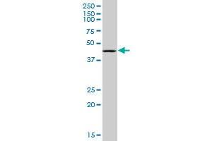 RING1 monoclonal antibody (M07), clone 4E8. (RING1 antibody  (AA 81-170))