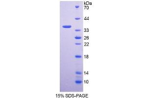 SDS-PAGE analysis of Human GNMT Protein. (GNMT Protein)