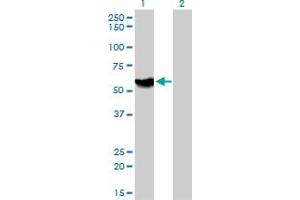 Western Blot analysis of ATP6AP1 expression in transfected 293T cell line by ATP6AP1 monoclonal antibody (M01), clone 3A2.