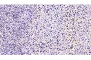 Detection of NRGN in Human Spleen Tissue using Monoclonal Antibody to Neurogranin (NRGN) (Neurogranin antibody  (AA 1-67))
