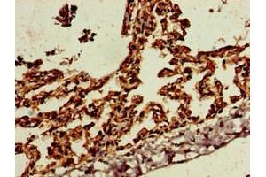Immunohistochemistry of paraffin-embedded human lung tissue using ABIN7169773 at dilution of 1:100