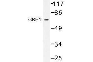 Image no. 1 for anti-GTP Binding Protein 1 (GTPBP1) antibody (ABIN317811)