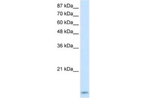 Western Blotting (WB) image for anti-TAR (HIV-1) RNA Binding Protein 2 (TARBP2) antibody (ABIN2462162) (TARBP2 antibody)