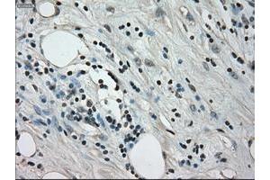 Image no. 4 for anti-Crystallin, alpha B (CRYAB) antibody (ABIN1497645) (CRYAB antibody)