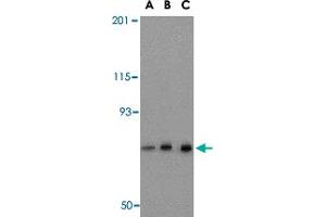 Western blot analysis of NCSTN in mouse brain tissue lysate with NCSTN polyclonal antibody  at (A) 0. (Nicastrin antibody  (C-Term))