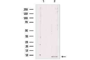 Western blot analysis of extracts from Mouse cancer, using RPL39 Antibody. (RPL39 antibody  (C-Term))