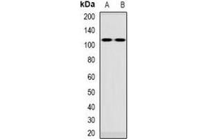 Western blot analysis of VPS54 expression in Jurkat (A), rat blood (B) whole cell lysates. (VPS54 antibody)