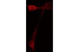 ABIN6267397 staining NIH-3T3 cells by IF/ICC. (CD44 antibody  (pSer706))