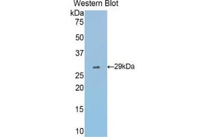 Western blot analysis of the recombinant protein. (Fascin antibody  (AA 27-273))